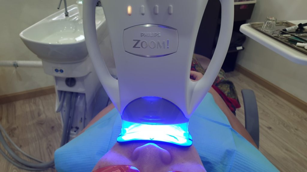 Getting a million dollar smile - the Zoom teeth whitening experience from start to finish 3